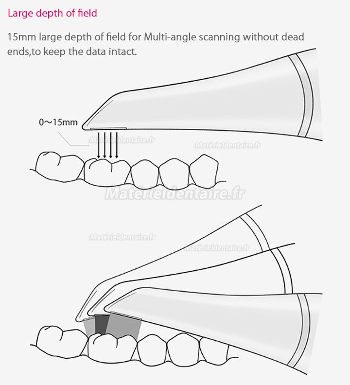 Scanner intraoral numérique dentaire 3D Fussen